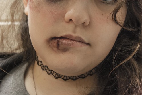 A woman with a bruised lip